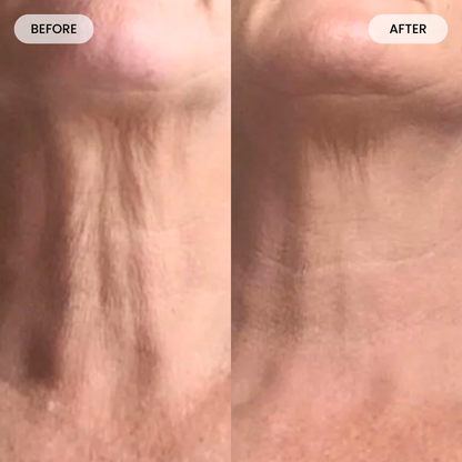 Get Lumoris Radiance Pro LED Neck & Décolletage Mask