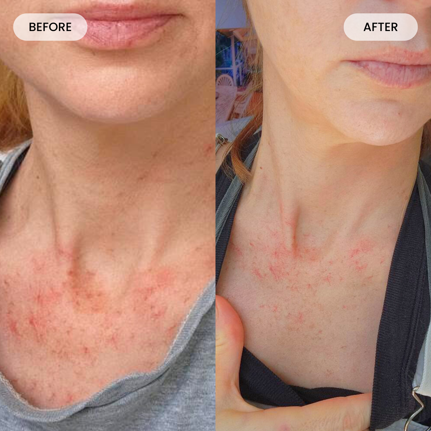 Get Lumoris Radiance Pro LED Neck & Décolletage Mask